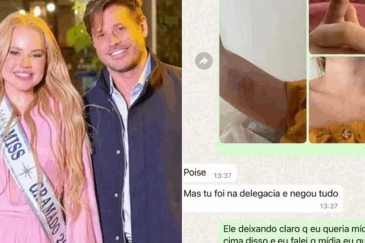 Ex de Dado Dolabella expõe agressões e obtém medida protetiva