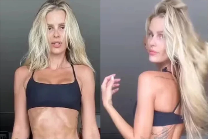 Vídeo de antes e depois de Yasmin Brunet deixa os fãs da modelo chocados; ela perdeu 15kg