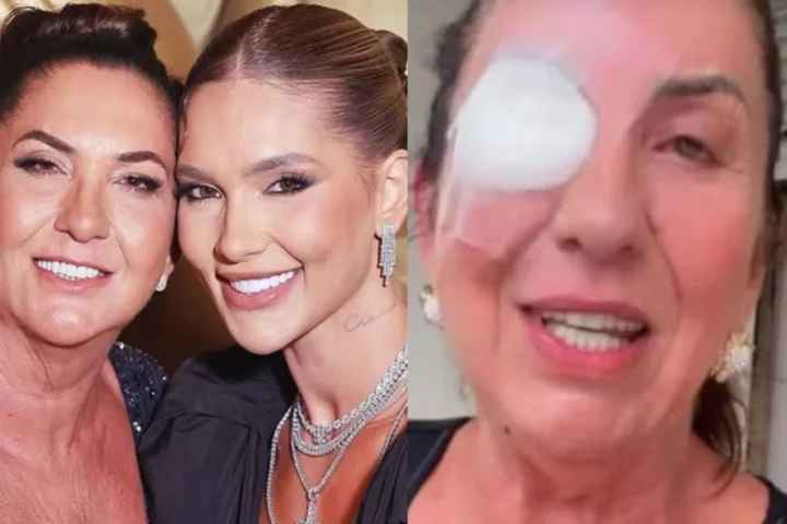 Mãe de Virginia Fonseca surge com curativo e conta o motivo da cirurgia