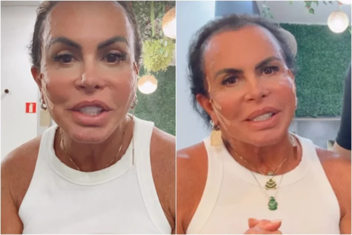 Gretchen mostra cabelo real em meio a problema de saúde